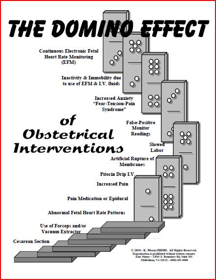 Domino Effect picture